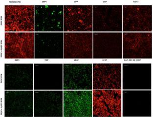 Dual ECM Biomimetic Scaffolds for Dental Pulp Regenerative Applications